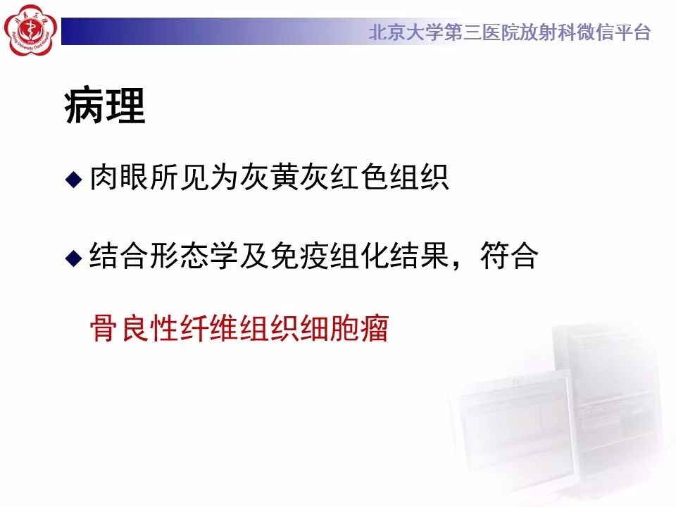 【病例】脊柱良性纤维组织细胞瘤1例CT及MR