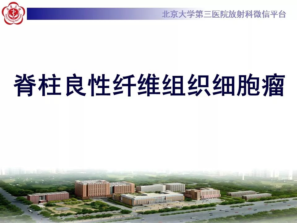 【病例】脊柱良性纤维组织细胞瘤1例CT及MR