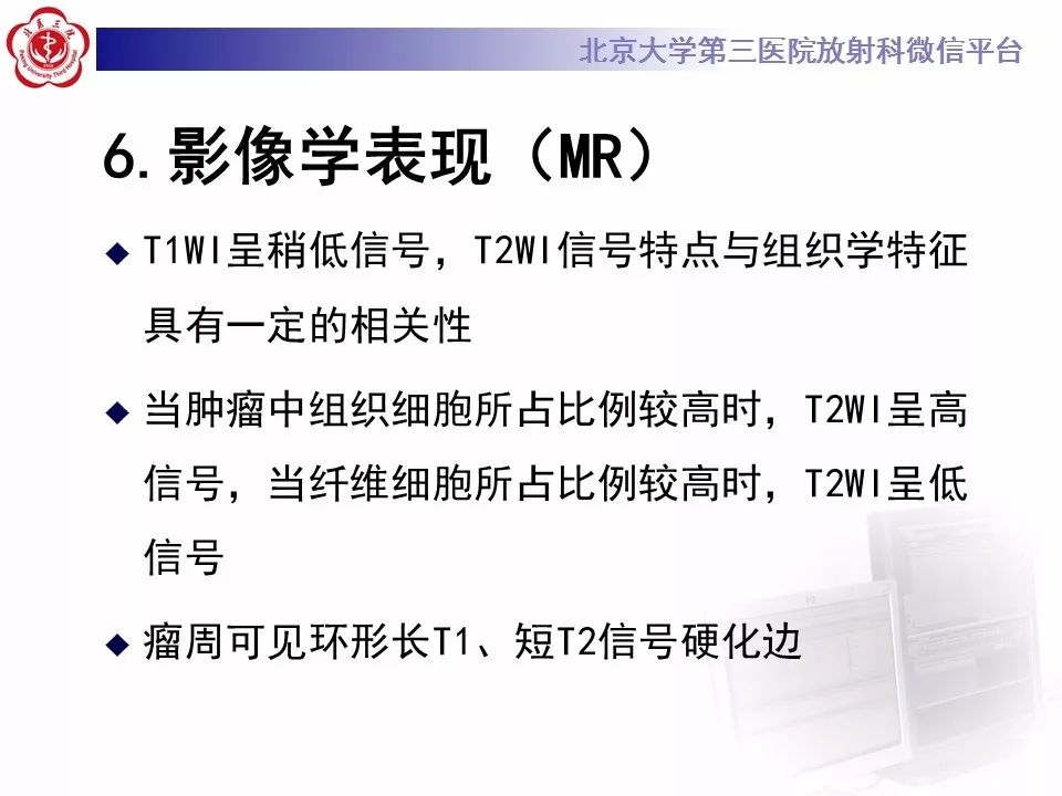 【病例】脊柱良性纤维组织细胞瘤1例CT及MR