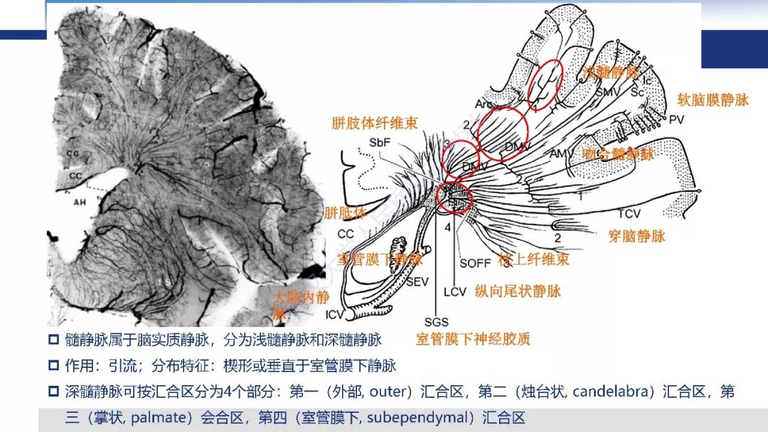 【PPT】大脑髓静脉解剖及疾病影像诊断