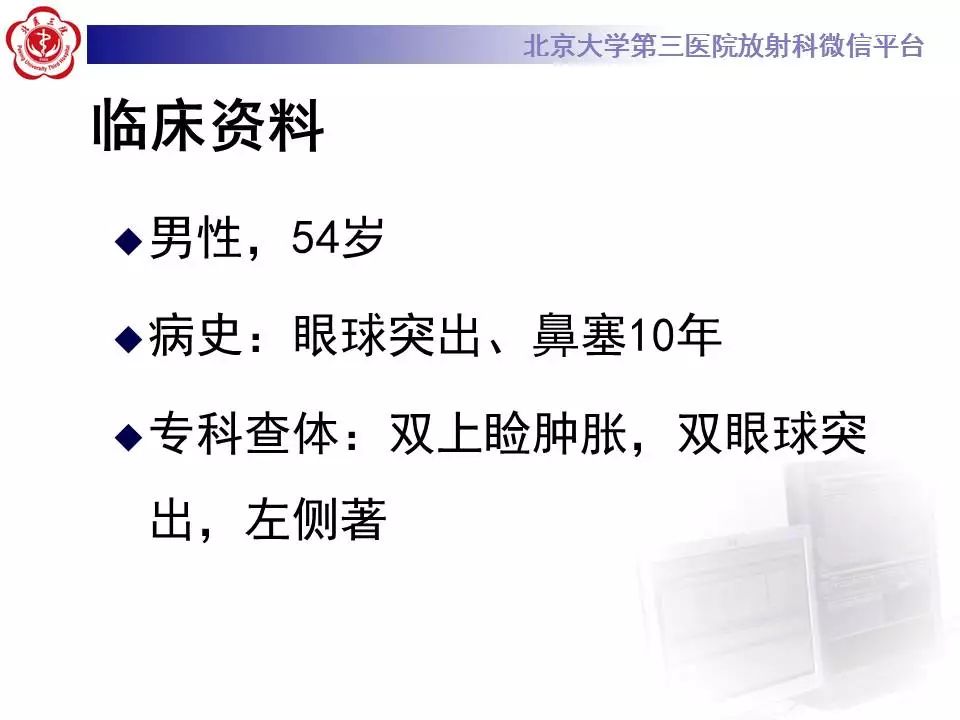 【病例】眼眶炎性假瘤1例CT影像诊断