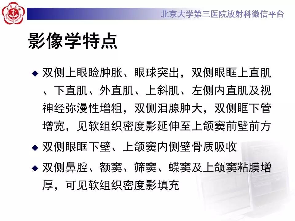 【病例】眼眶炎性假瘤1例CT影像诊断