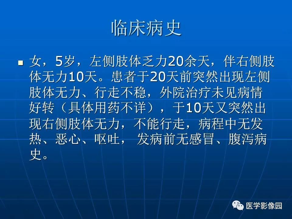 【病例】基底节区脱髓鞘假瘤1例MR