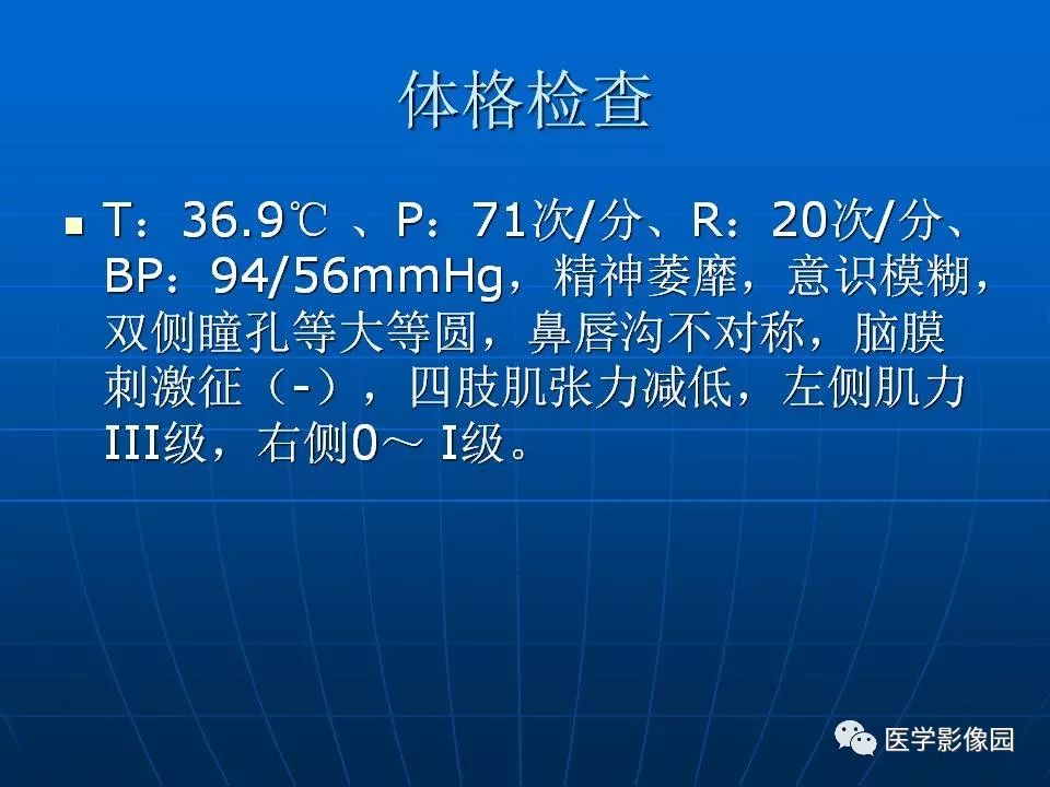 【病例】基底节区脱髓鞘假瘤1例MR 【病例】基底节区脱髓鞘假瘤1例MR