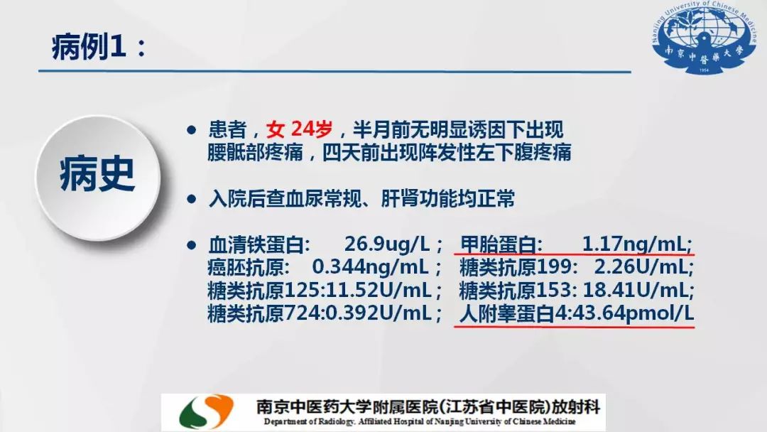 【PPT】孤立性纤维瘤的影像学表现