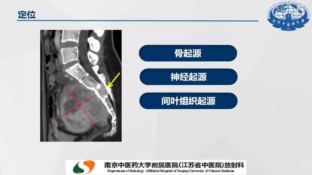 【PPT】孤立性纤维瘤的影像学表现