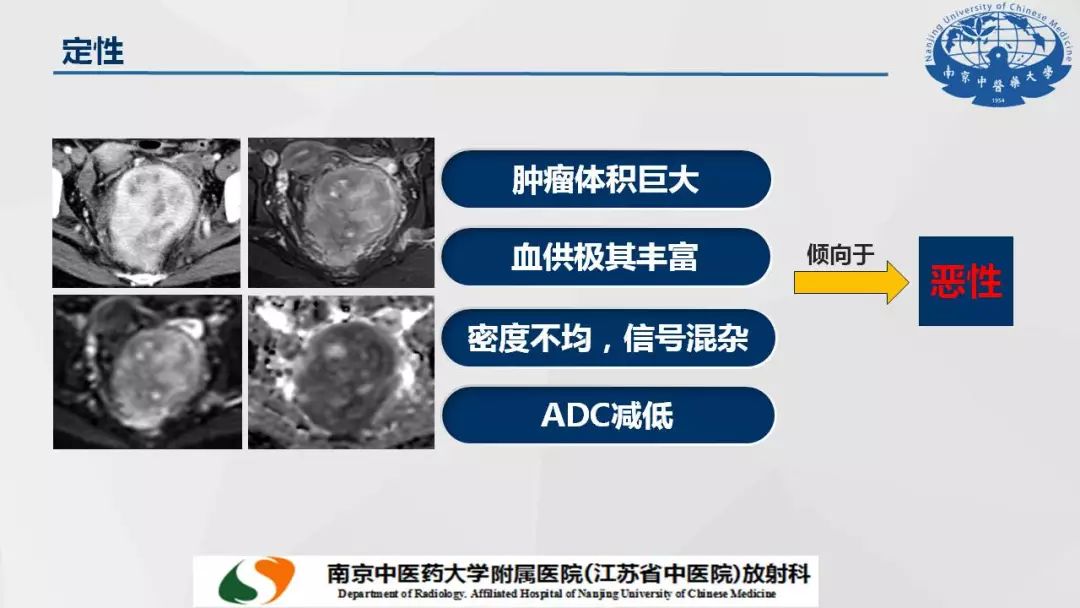【PPT】孤立性纤维瘤的影像学表现