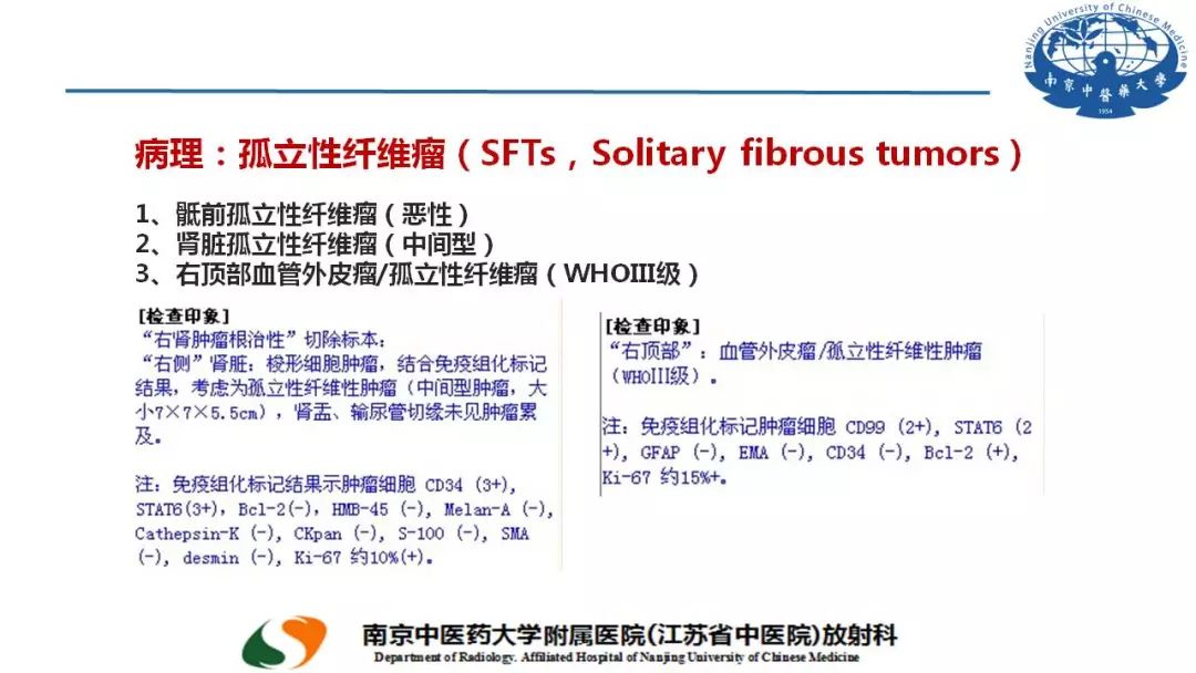 【PPT】孤立性纤维瘤的影像学表现