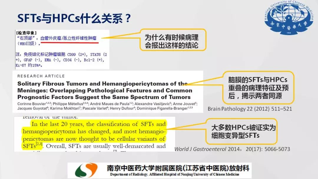 【PPT】孤立性纤维瘤的影像学表现