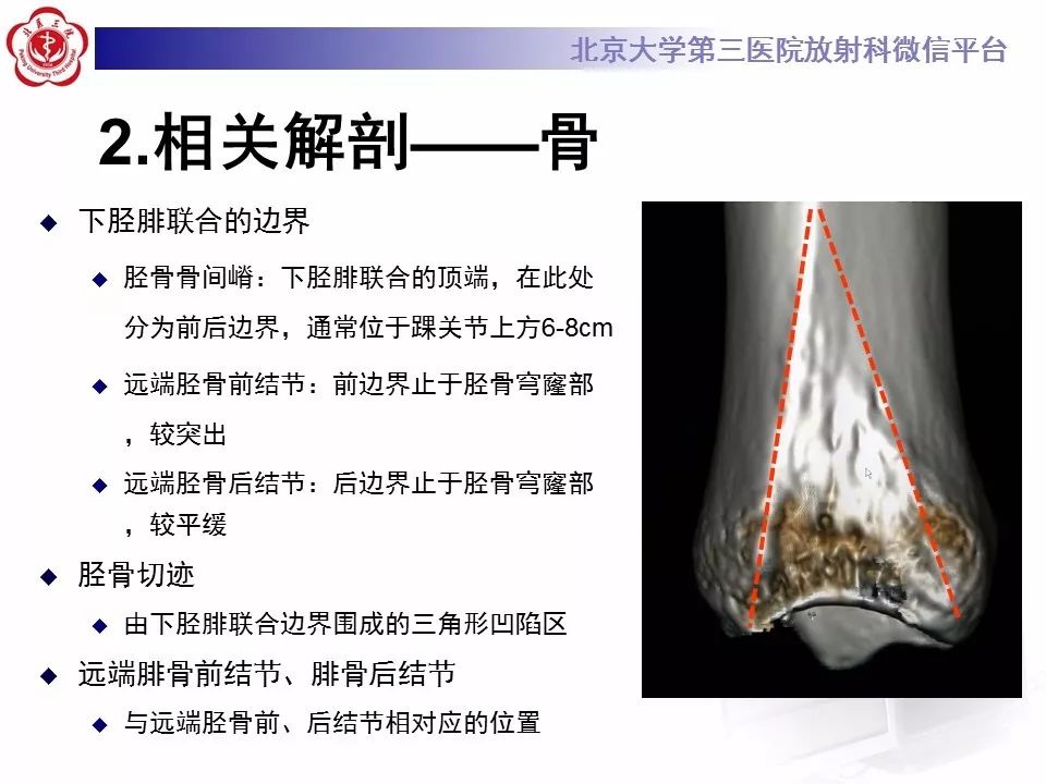 【病例】下胫腓联合韧带损伤1例影像表现