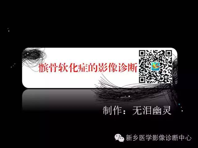 【PPT】髌骨软化症的影像诊断