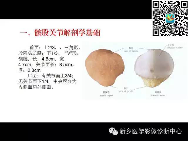 【PPT】髌骨软化症的影像诊断