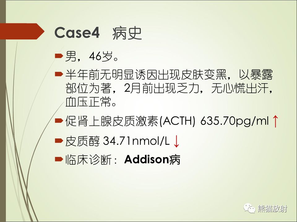 【PPT】双侧肾上腺病变5例