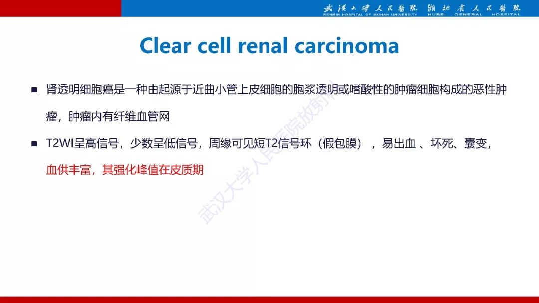 【PPT】肾脏嗜酸细胞腺瘤影像诊断