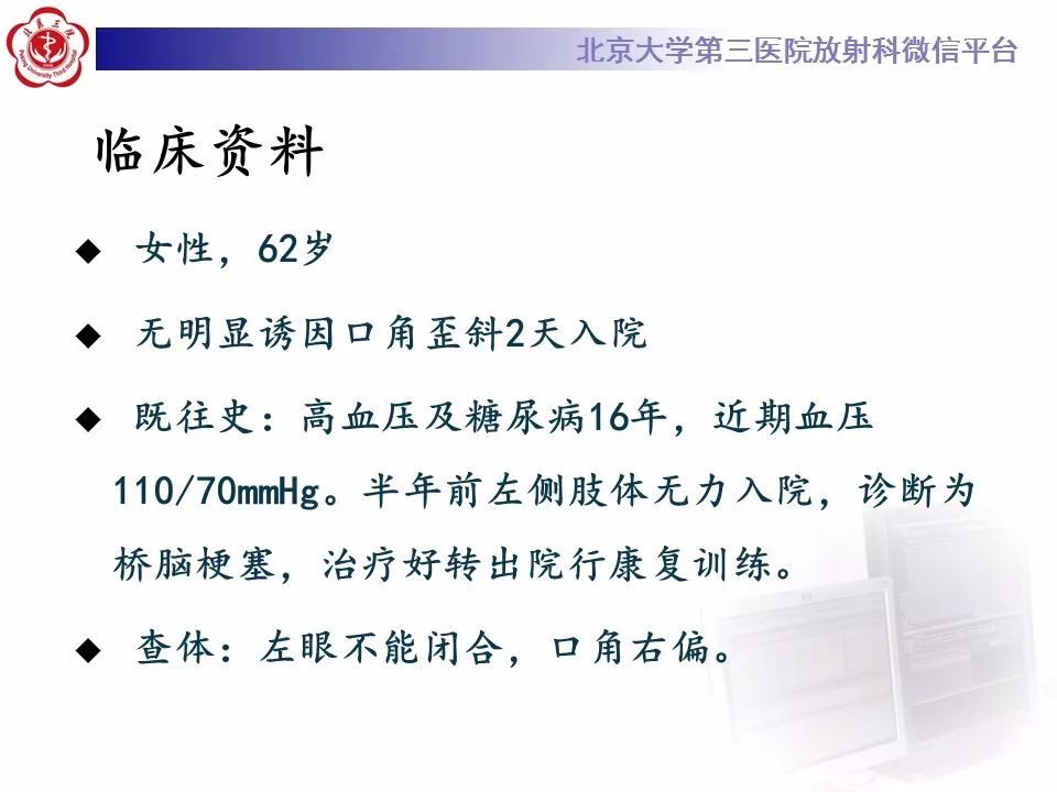 【病例】脑桥小脑束华勒变性1例MR