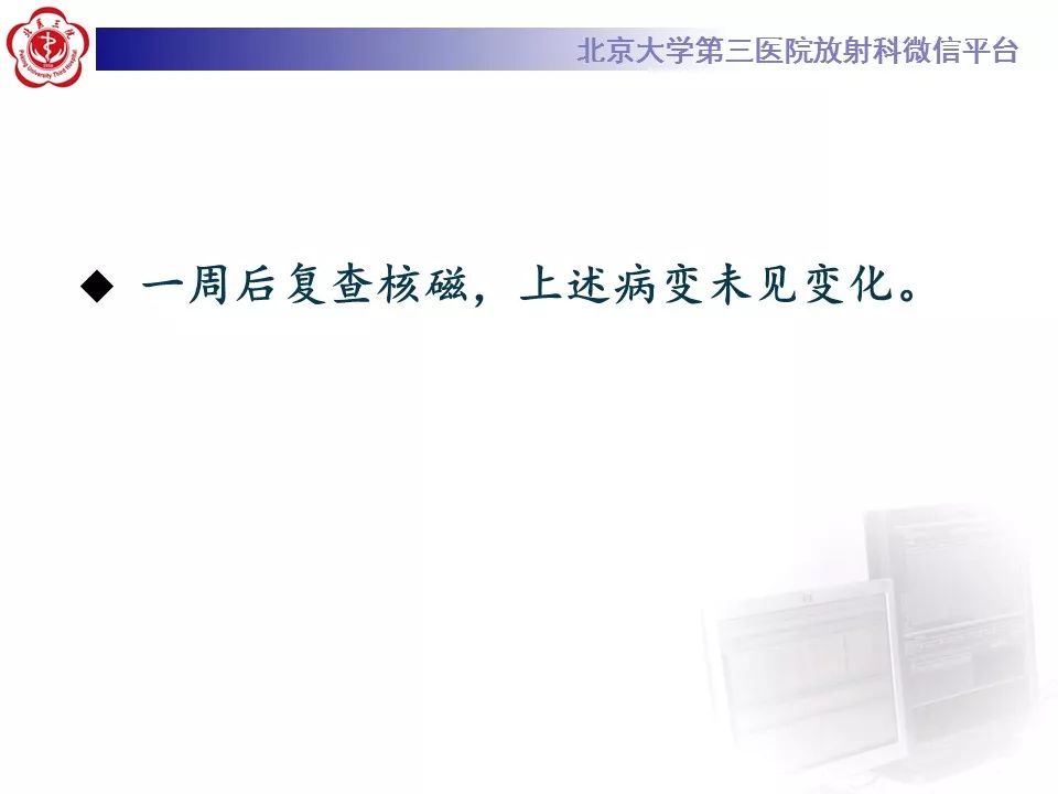【病例】脑桥小脑束华勒变性1例MR