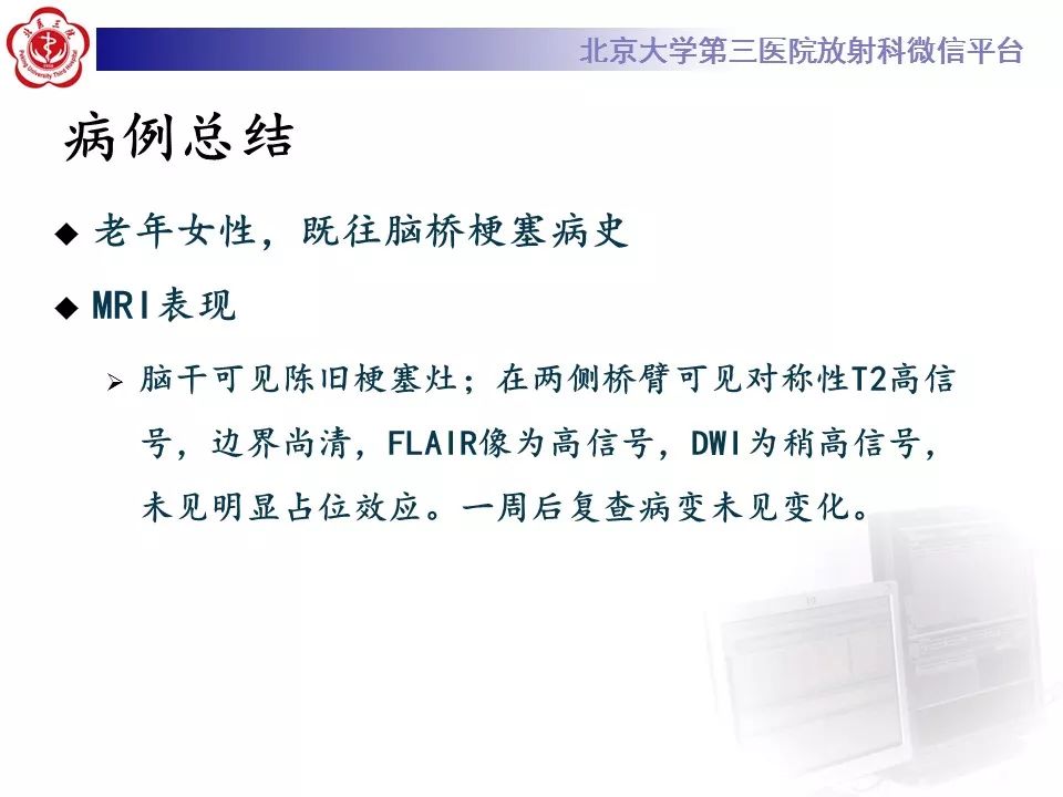 【病例】脑桥小脑束华勒变性1例MR