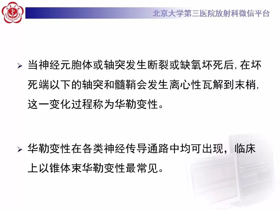 【病例】脑桥小脑束华勒变性1例MR