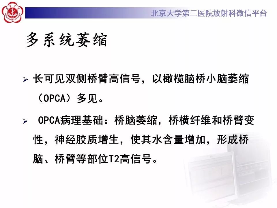 【病例】脑桥小脑束华勒变性1例MR