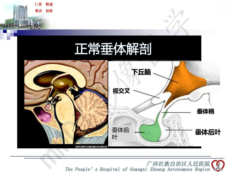 【PPT】垂体非肿瘤性病变MR诊断