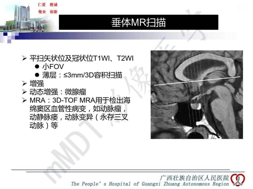 【PPT】垂体非肿瘤性病变MR诊断