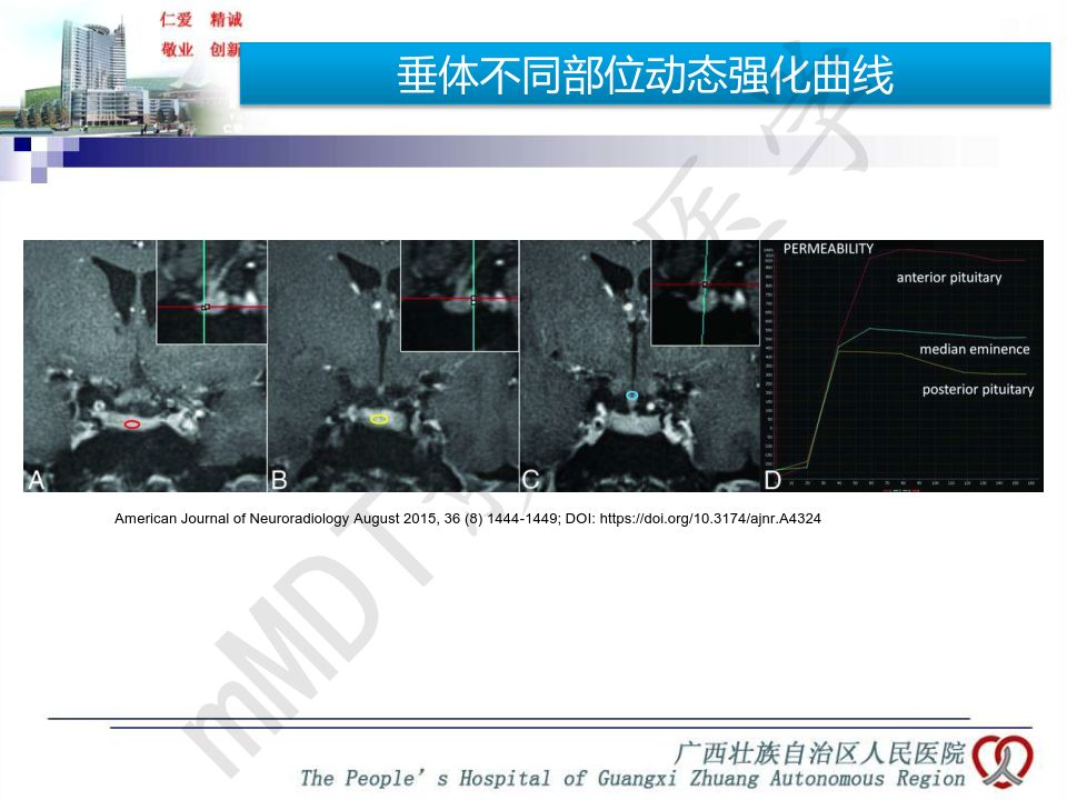【PPT】垂体非肿瘤性病变MR诊断