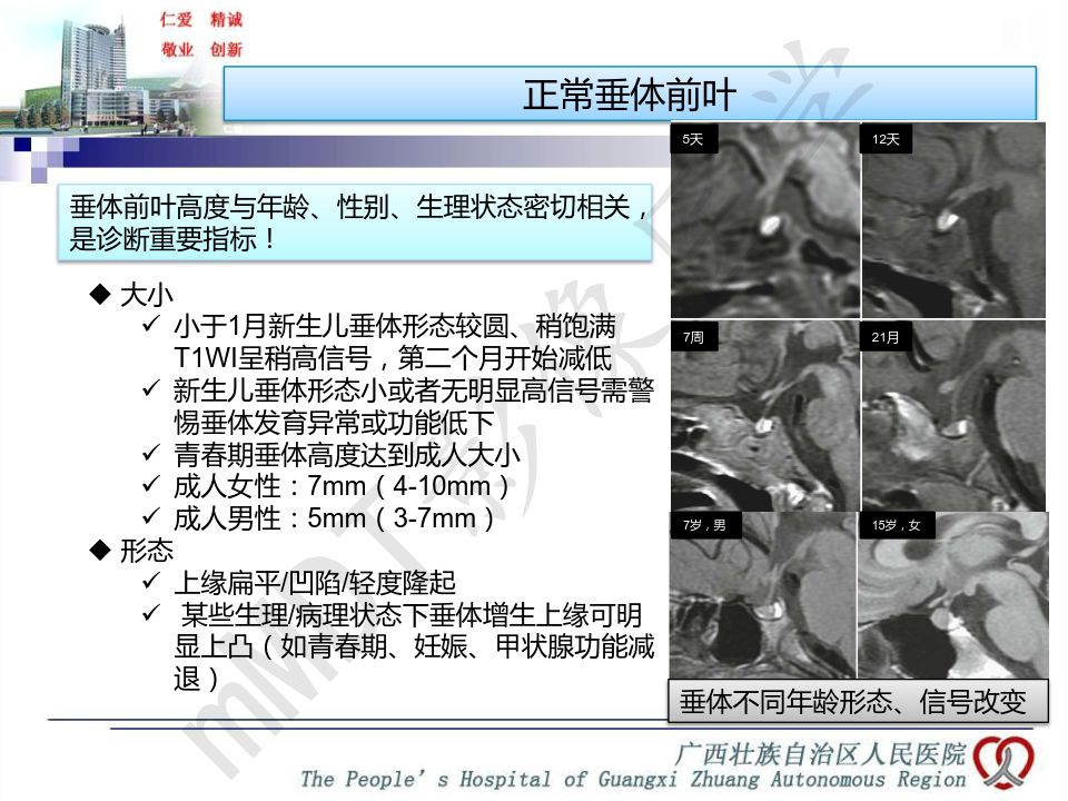 【PPT】垂体非肿瘤性病变MR诊断