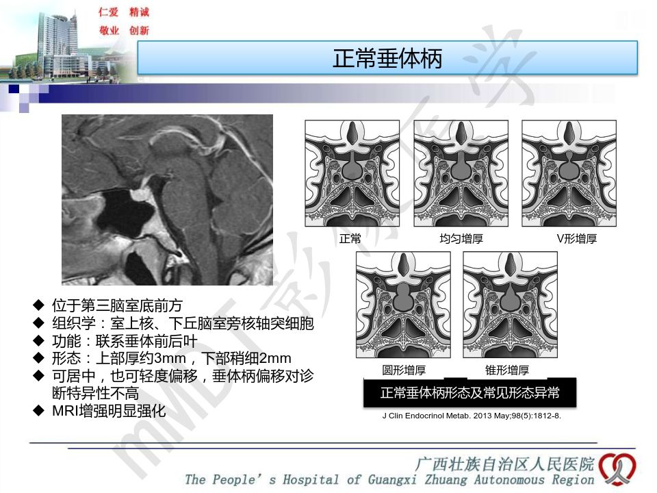【PPT】垂体非肿瘤性病变MR诊断
