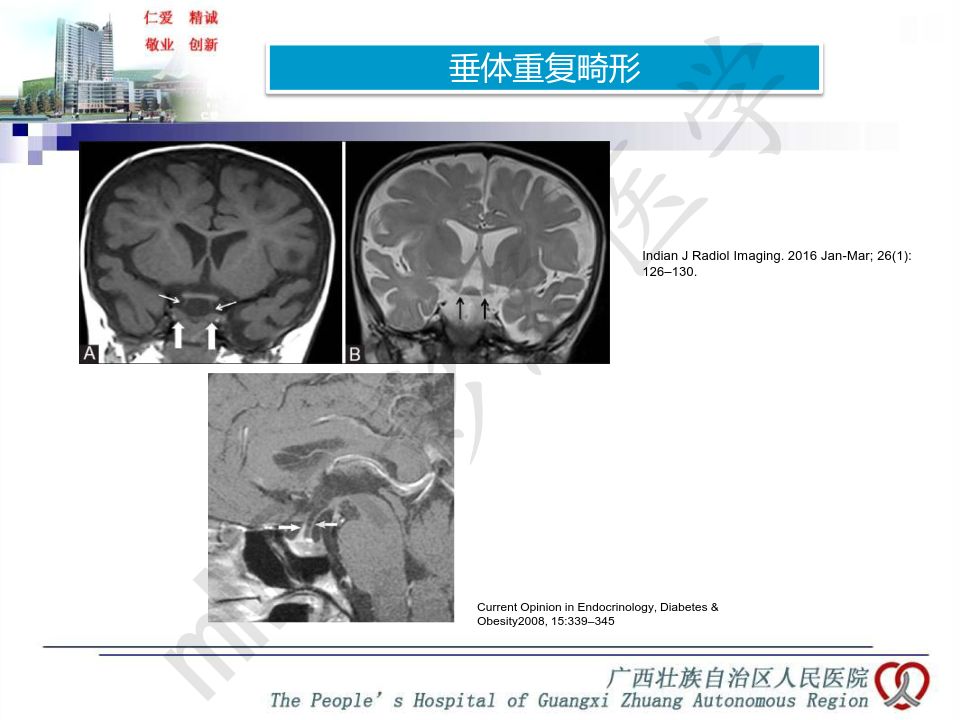 【PPT】垂体非肿瘤性病变MR诊断