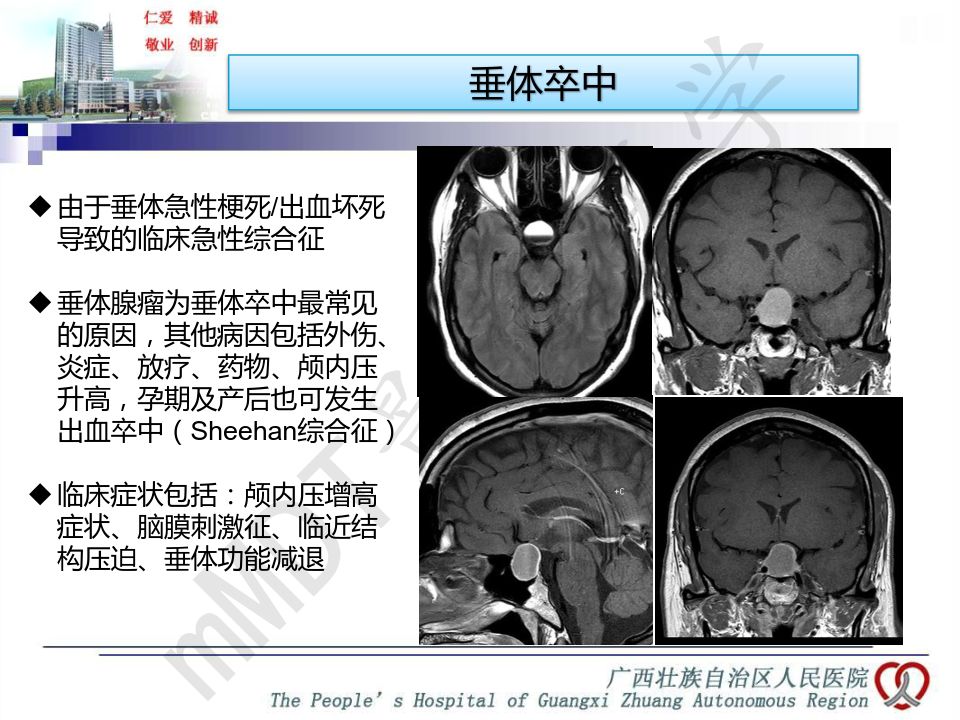 【PPT】垂体非肿瘤性病变MR诊断