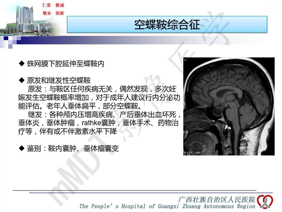 【PPT】垂体非肿瘤性病变MR诊断