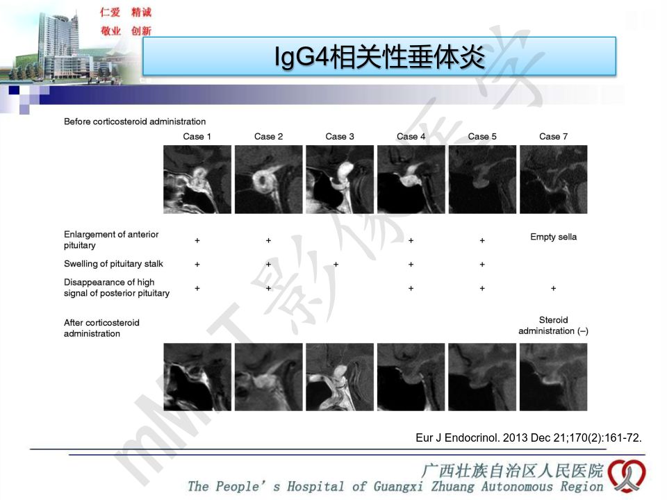 【PPT】垂体非肿瘤性病变MR诊断