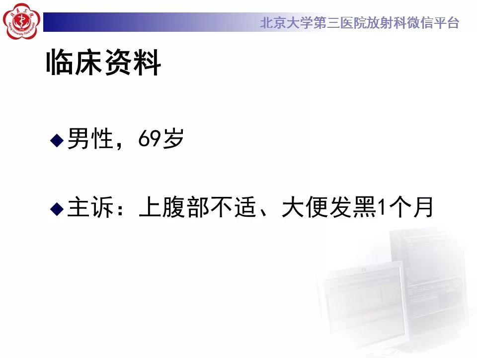 【病例】小肠原发性淋巴瘤1例CT影像表现