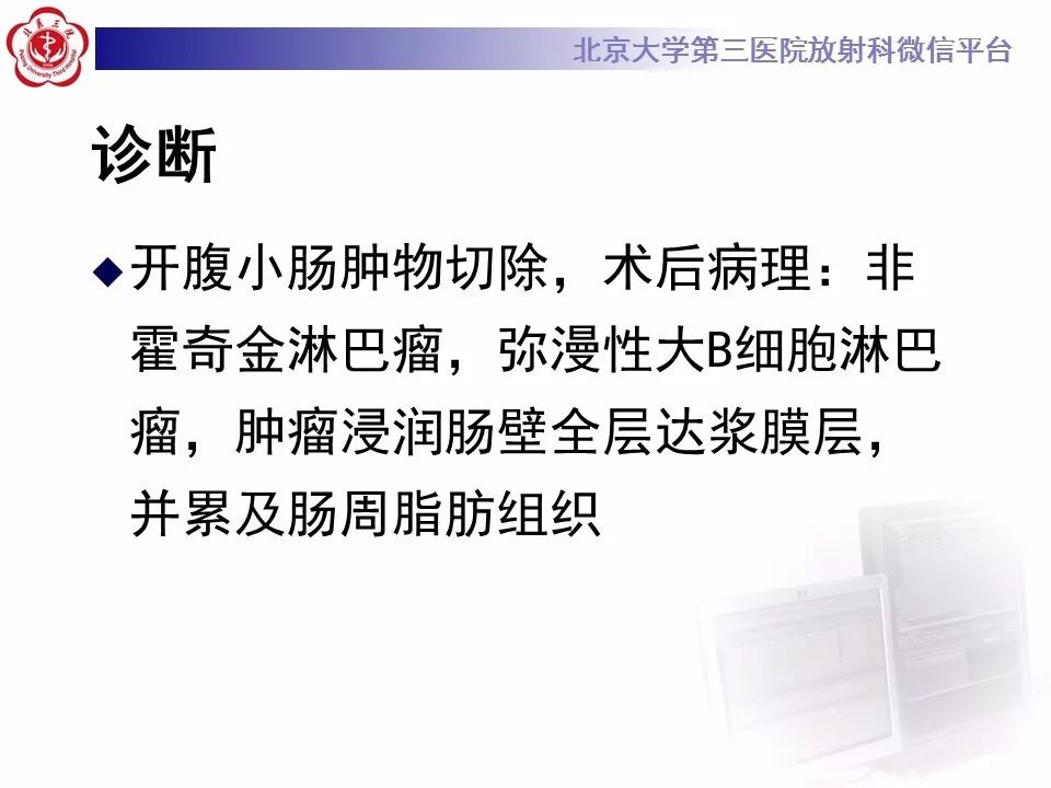 【病例】小肠原发性淋巴瘤1例CT影像表现