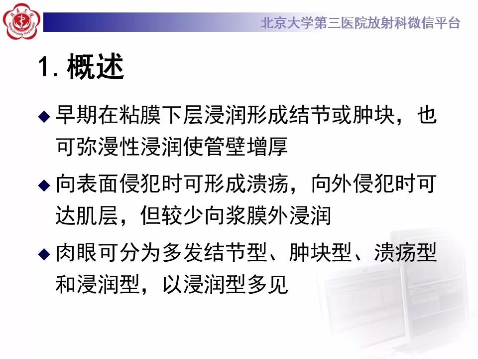 【病例】小肠原发性淋巴瘤1例CT影像表现