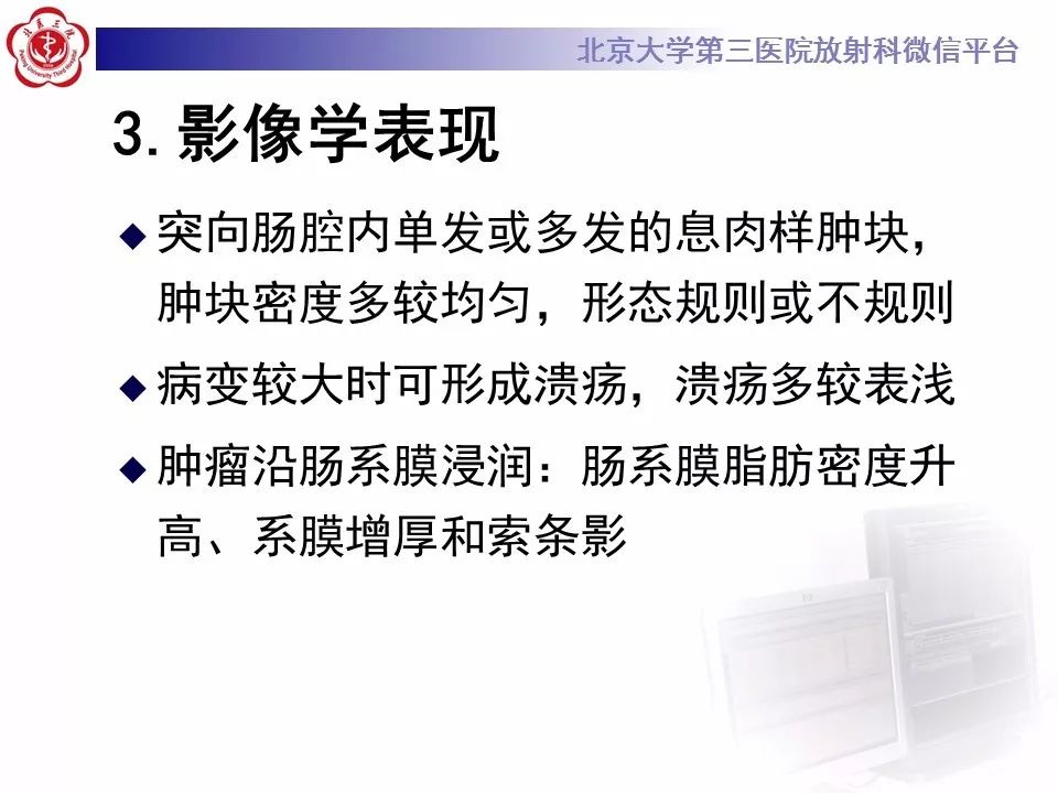 【病例】小肠原发性淋巴瘤1例CT影像表现