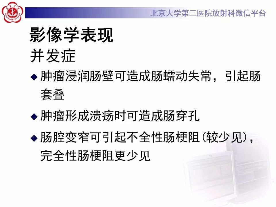 【病例】小肠原发性淋巴瘤1例CT影像表现
