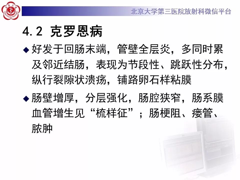 【病例】小肠原发性淋巴瘤1例CT影像表现