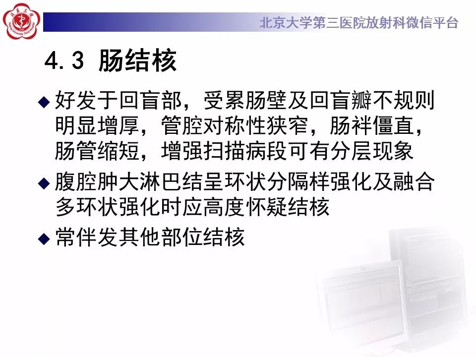 【病例】小肠原发性淋巴瘤1例CT影像表现