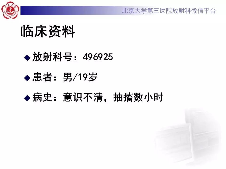 【病例】胚胎发育不良性神经上皮瘤1例