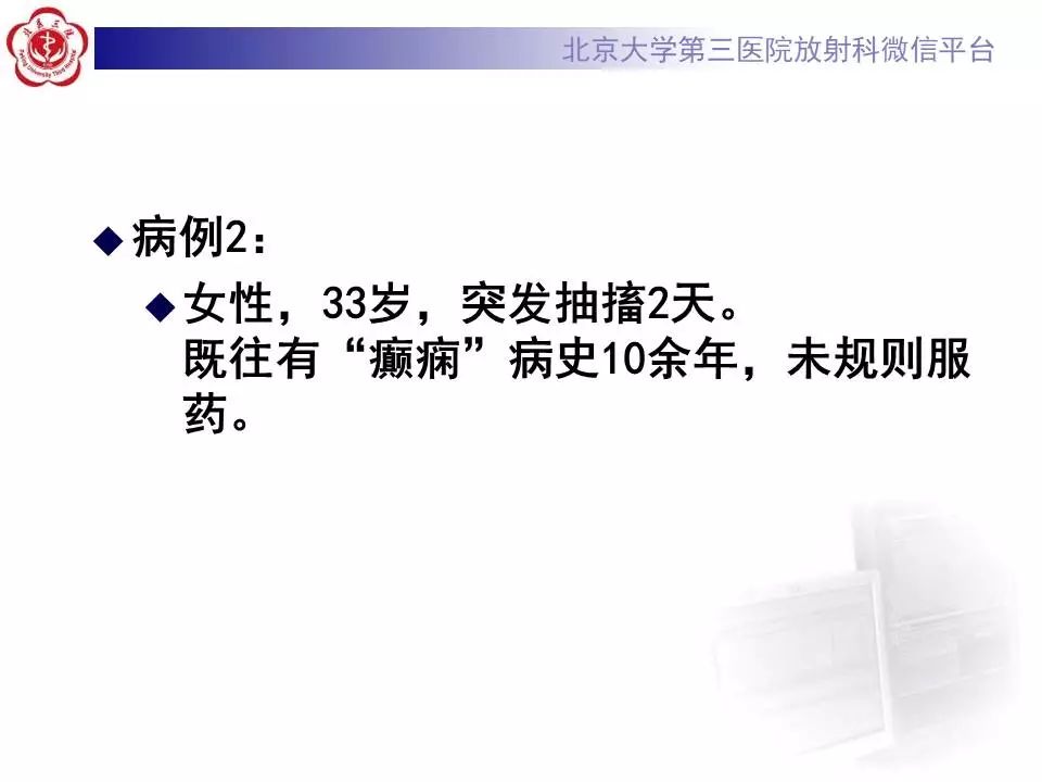 【病例】胚胎发育不良性神经上皮瘤1例