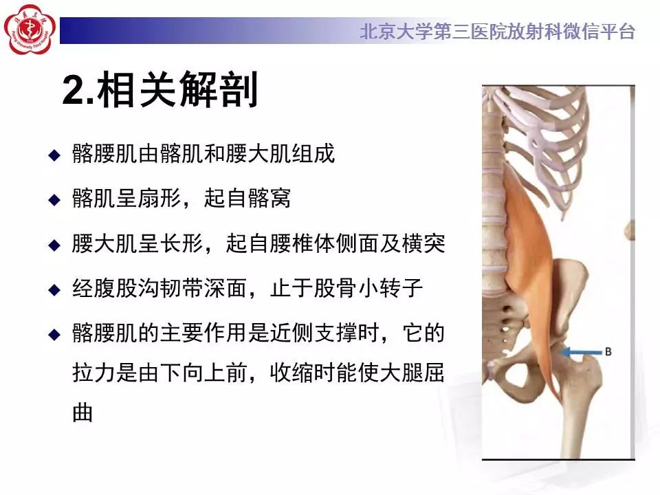 【病例】髂腰肌撞击1例MR影像表现