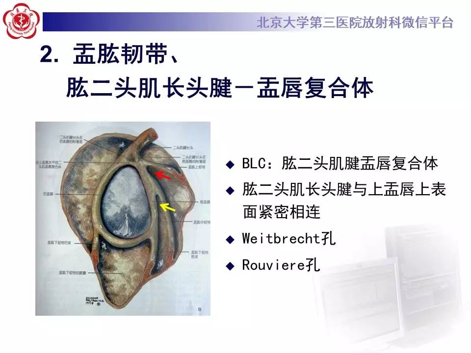 【PPT】肩关节MR造影正常表现