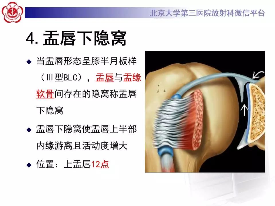 【PPT】肩关节MR造影正常表现