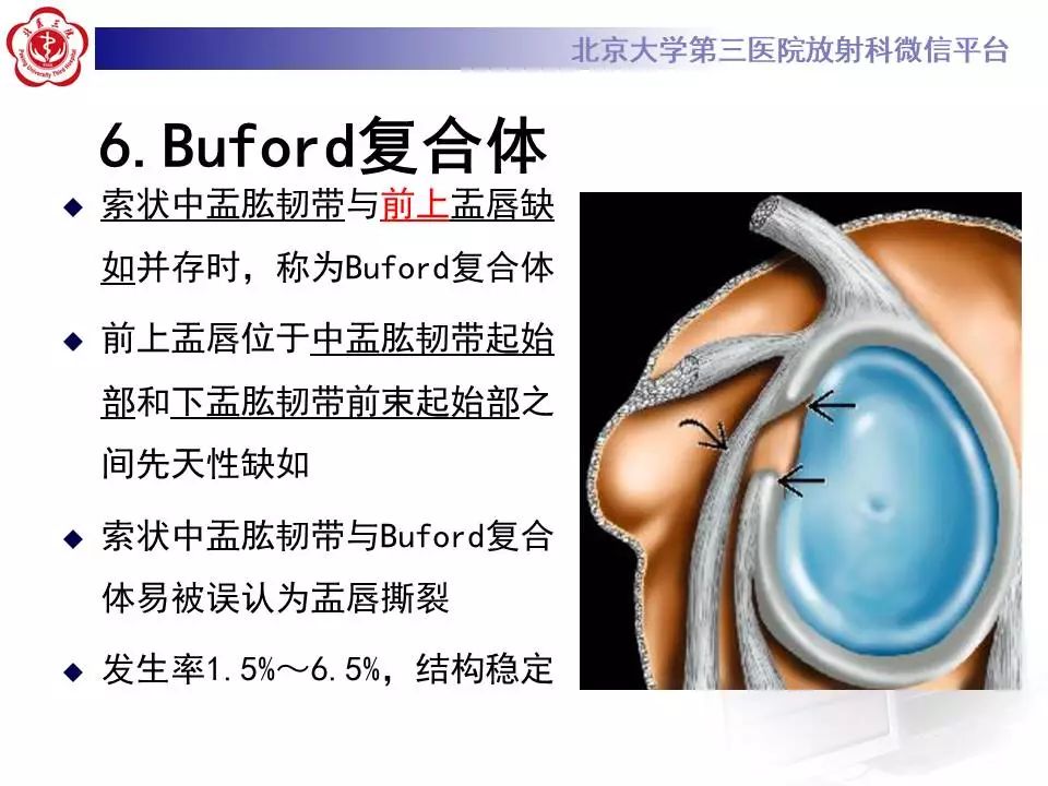 【PPT】肩关节MR造影正常表现