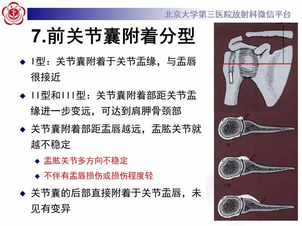 【PPT】肩关节MR造影正常表现