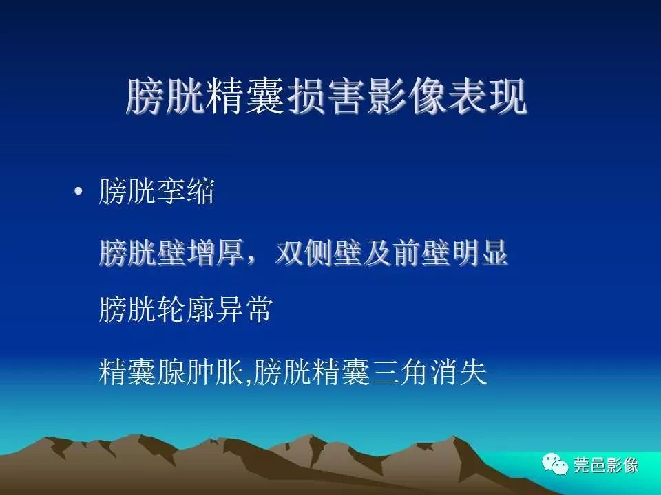 【PPT】氯胺酮相关性肝胆、泌尿系统损害的CT诊断