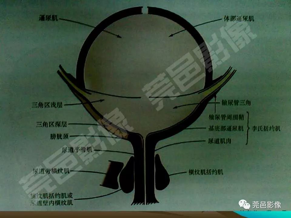 【PPT】氯胺酮相关性肝胆、泌尿系统损害的CT诊断
