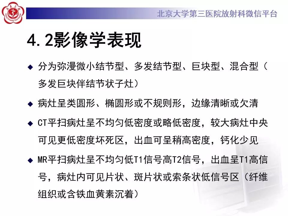 【PPT】肝血管源性肿瘤