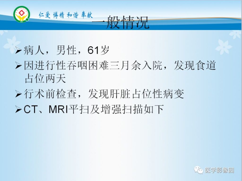 【病例】典型肝脏FNH一例CT及MR影像表现